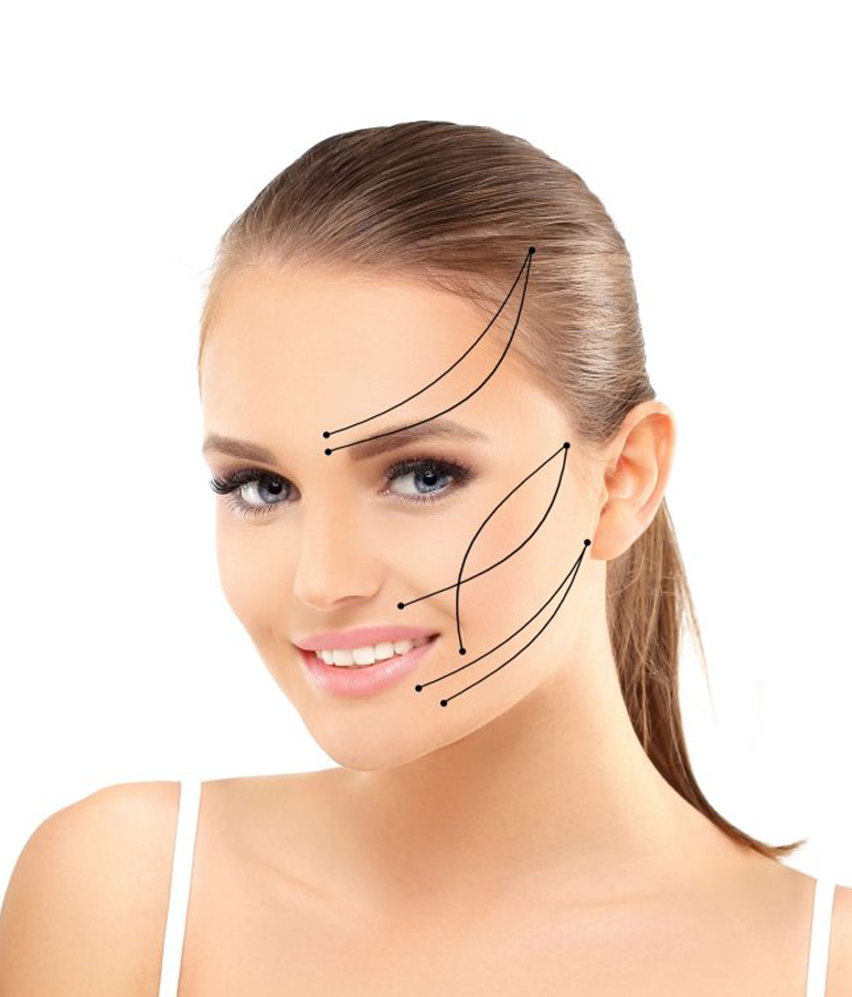 Thread Lift